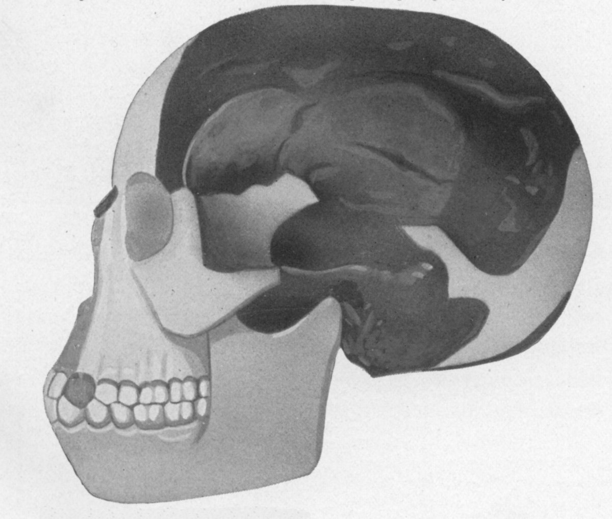 A 1922 reconstruction of the Piltdown skull, with surviving material shown against restored portions. The image records how the proposed fossil was visualised before the hoax was exposed.